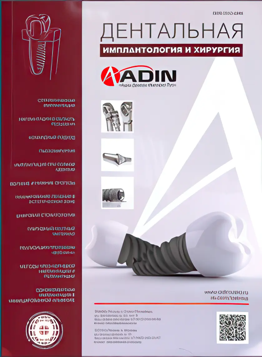 dentalnaya_implantologiya_i_hirurgiya.webp