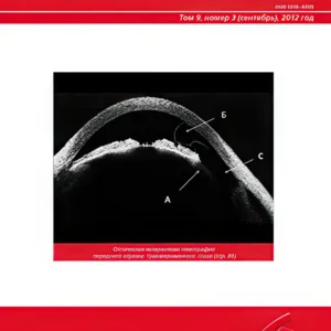 Офтальмология